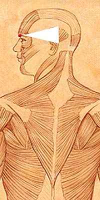 BL2 . Zan Zhu